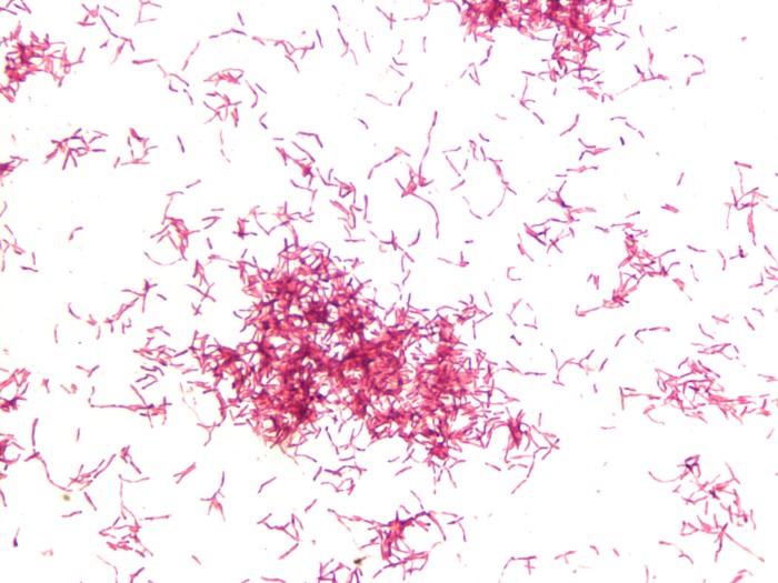 Actinomyces Aktueller Forschungs berblick